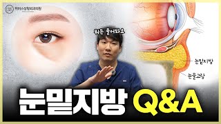 🤔많이 질문하는 눈밑지방재배치 Q&A
