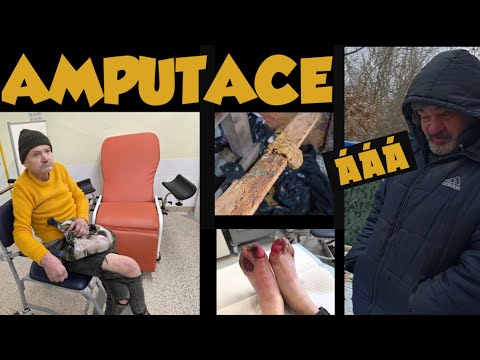 Psychopat vs Hrabě PO AMPUTACI!PsychoDan a Kačenka V BB!