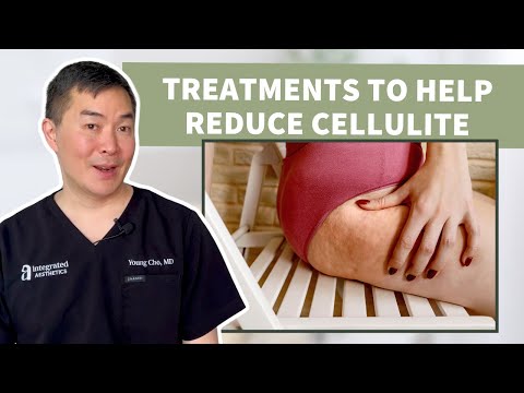 Ditch Cellulite for Good with the Latest Effective Solutions