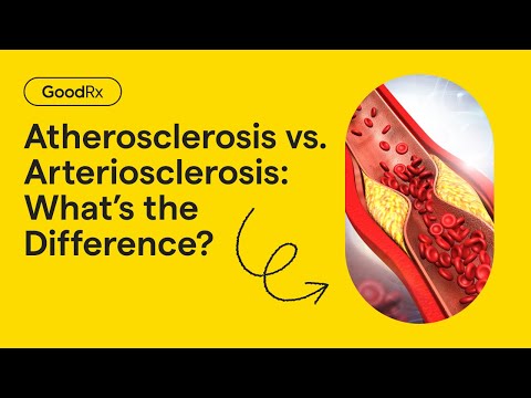 Atherosclerosis vs. Arteriosclerosis: What’s the Difference? | GoodRx