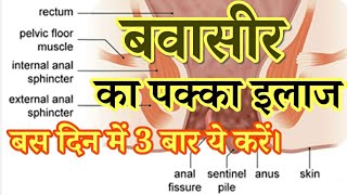 बवासीर से छुटकारा हमेशा के लिए । Piles Treatment in Hindi | Health Tips | DOWNLOAD THIS VIDEO IN MP3, M4A, WEBM, MP4, 3GP ETC