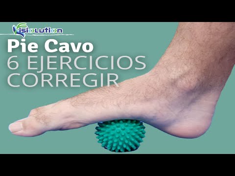 Pes cavus - 6 best exercises to correct and prevent pain | Fisiolution