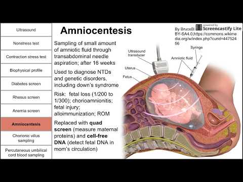 Prenatal screening, fetal testing, and other tests during pregnancy
