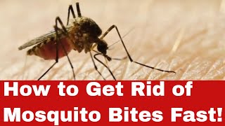 No More Itch: How to Get Rid of Mosquito Bites Fast!