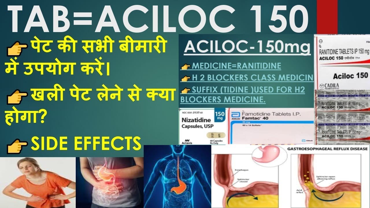 ACILOC-150 TABLET/USE/DOSE/SIDE EFFECTS/RANITIDINE/NIZATIDINE/FAMOTIDINE TABLET/STOMACH PAIN