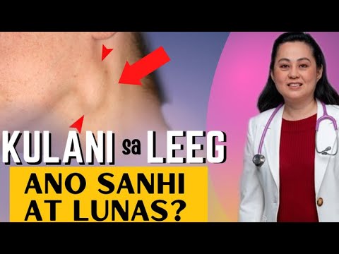 KULANI sa LEEG: Ano Sanhi at Lunas. - by ni Doc Liza Ramoso-Ong