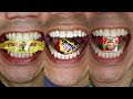ASMR Which Is You Favourite Chocolate