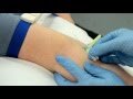 Cannulation: Introduction / update