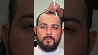 Selecting Your Perfect Base