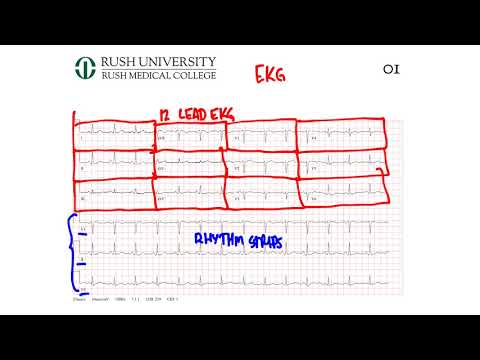 01 How to calculate rate on an EKG