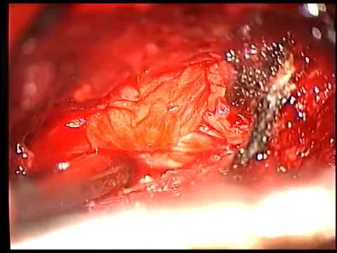 Lato dolente dal lato sinistro e dal retro Joint Centro di riabilitazione