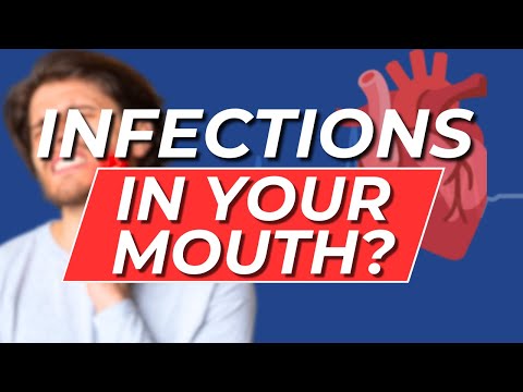 How Dental Infections Affect Your Health