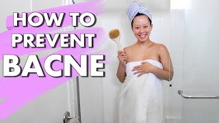 how to prevent back acne (pregnancy vlogs)