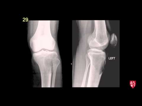 Radiology Boards Prep - MSK Cases