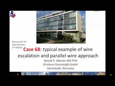 Case 68: Manual of CTO Interventions - Parallel wiring