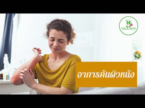 ยาและการรักษาโรคสะเก็ดเงิน ครีมครีมซาลิไซลิสำหรับโรคสะเก็ดเงิน