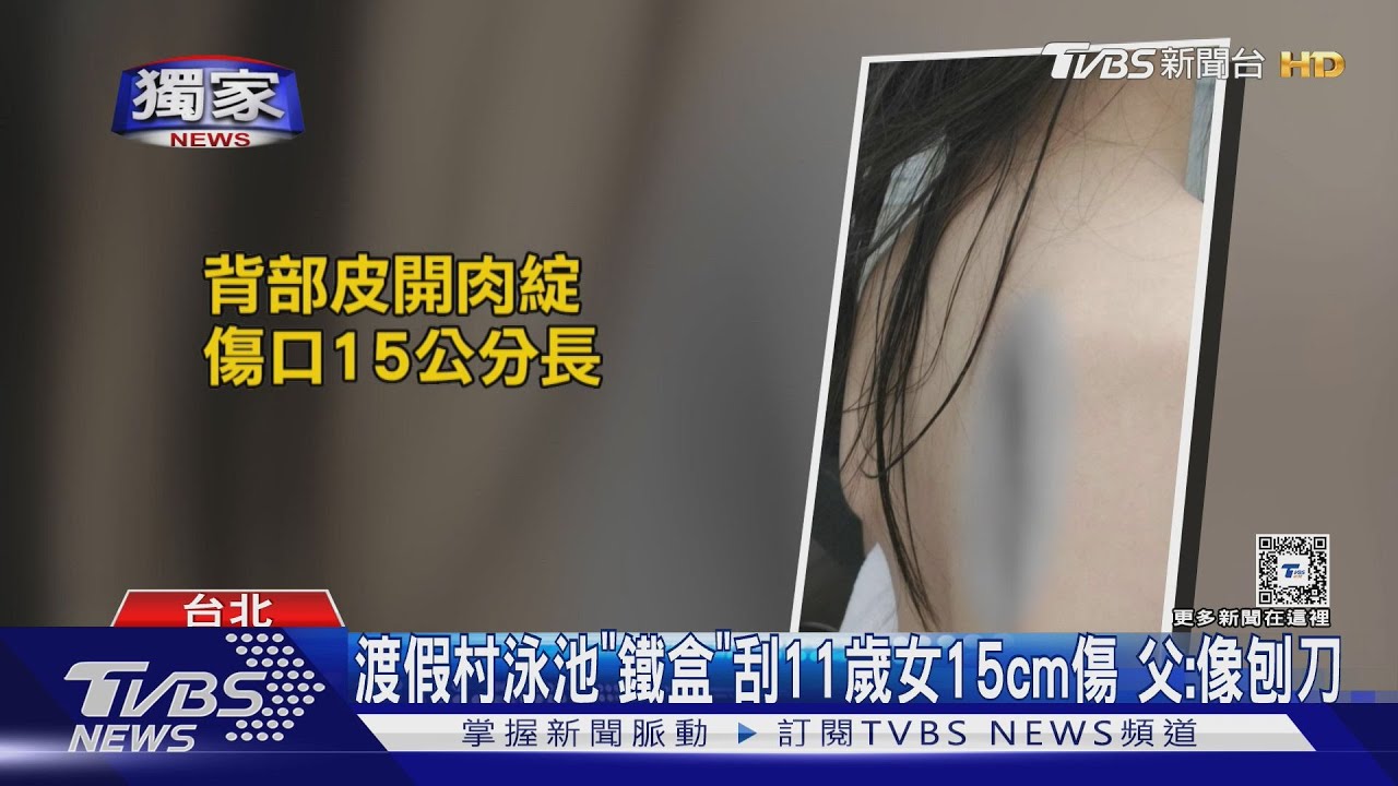 渡假村泳池「鐵盒」刮11歲女15cm傷 父:像刨刀