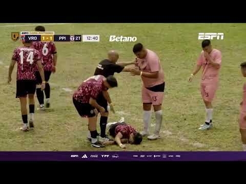 El fuerte topetazo que sacó a Nicolás Bertolo del partido