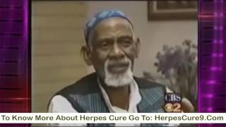 Dr  Sebi On Herpes Cure | Natural Cure For Herpes By Dr Sebi