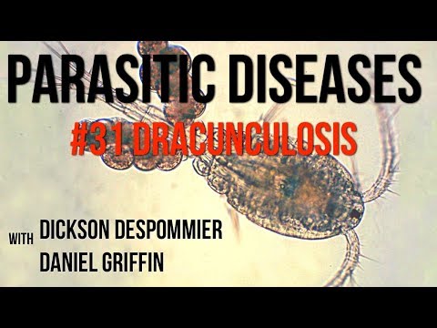 Parasites Without Borders, Parasitic Diseases Lectures #31: Dracunculiasis