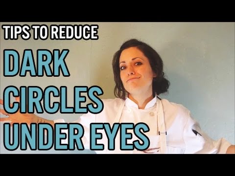How to Reduce Dark Circles Under Eyes Video