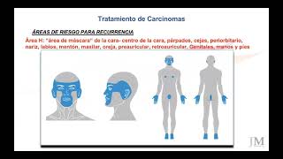 Cáncer de piel (Parte 2)