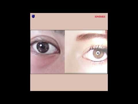 Video thumbnail _g93bd_ZJJU