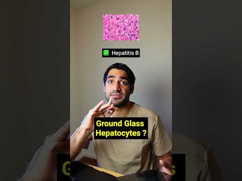 Rapid Review Pathology - The Final One’s a Toughie! 🔬