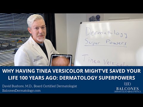 Why Having Tinea Versicolor Might’ve Saved Your Life 100 Years Ago | Dermatology Superpowers
