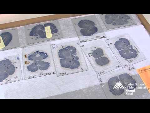 What it's like being in the Physician Scholar Program