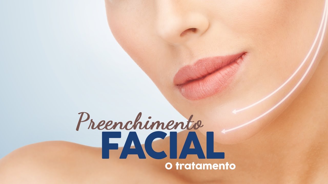 Preenchimento Facial