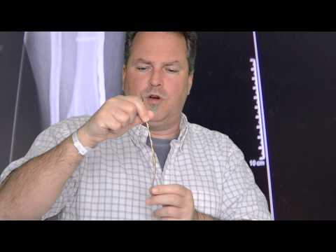 Titanium plate removal after broken leg