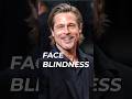 Brad Pitt Has Face Blindness? (Prosopagnosia Explained)