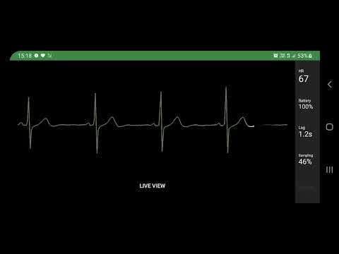 Cardio Capture for Polar H10