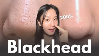 How to really remove blackheads at home in 7 days (+No matter your skin type)
