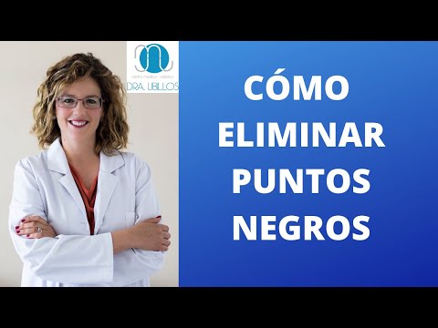 CÓMO ELIMINAR PUNTOS NEGROS