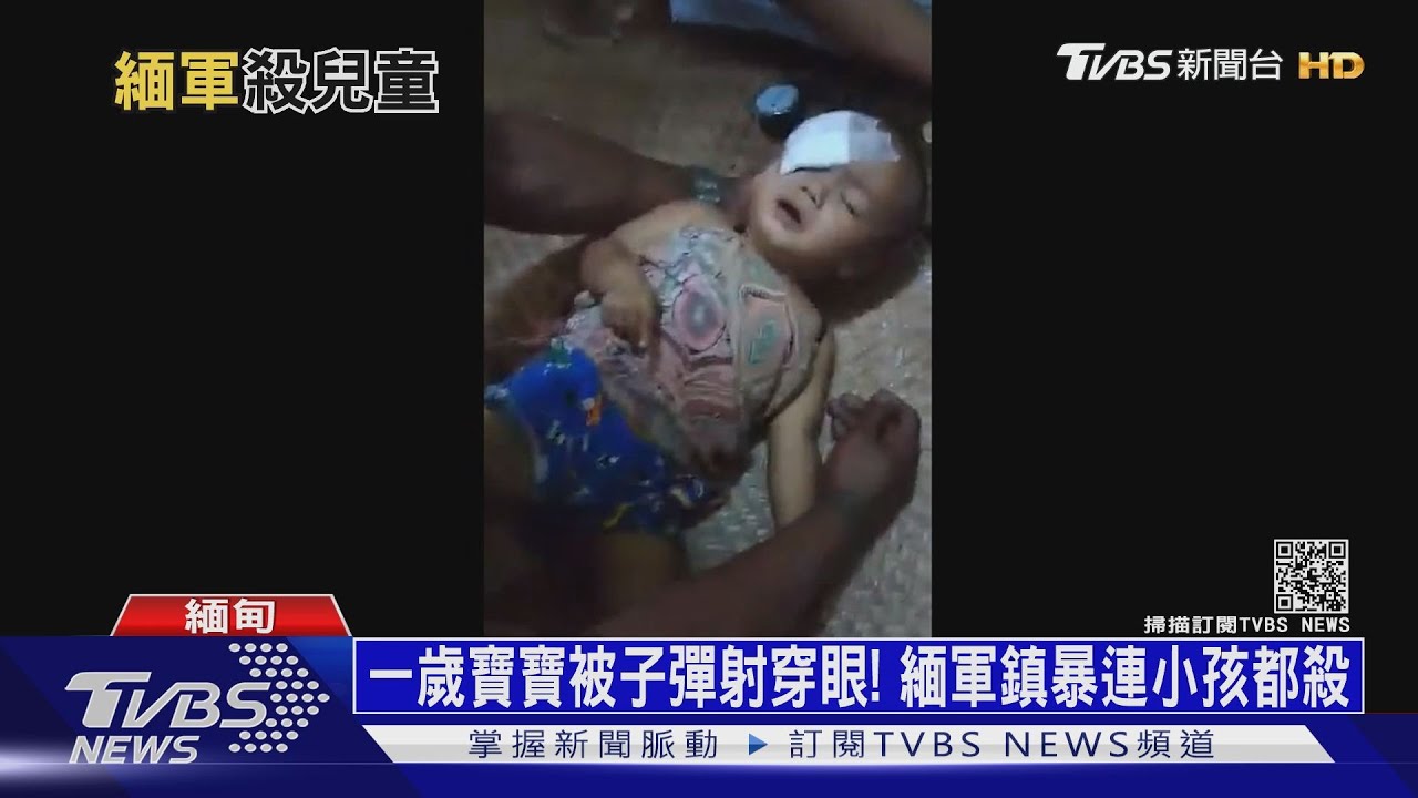 一歲寶寶被子彈射穿眼! 緬軍鎮暴連小孩都殺