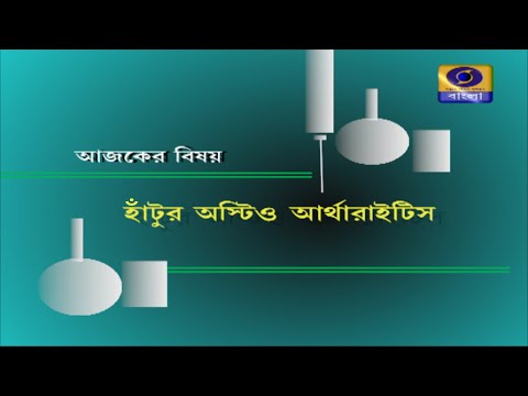 SUSWASTHA : হাঁটুর অস্টিও আর্থারাইটিস