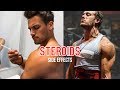 Steroids Side Effects - Marc Fitt