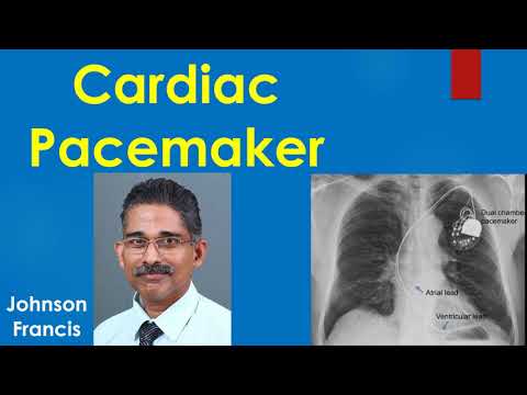 image-What can cause interference with a pacemaker?