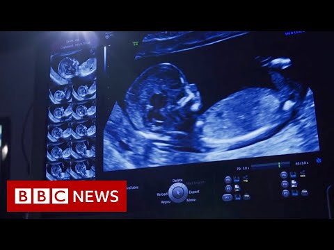 私人嬰兒掃描工作室 "越來越多的關注"--BBC News (Private baby scan studios ‘a growing concern’ - BBC News)