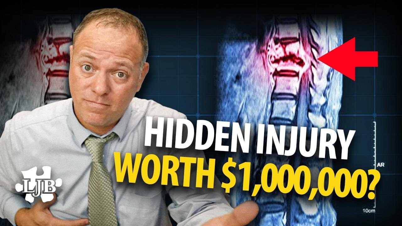 Can an Injury Go Undiagnosed After a Car Accident?