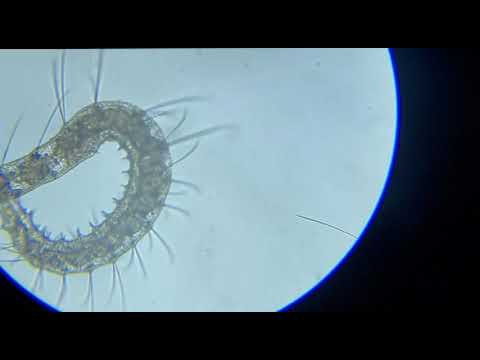 Detritus Worms Causes & How To Get Rid Of them
