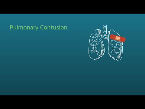 Chest Trauma: Pulmonary Contusion