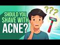 Should You Shave With Acne Teen Shaving Tips To Avoid Irritation And Breakouts