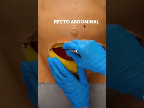 La cesárea representada en plastilina 🩷