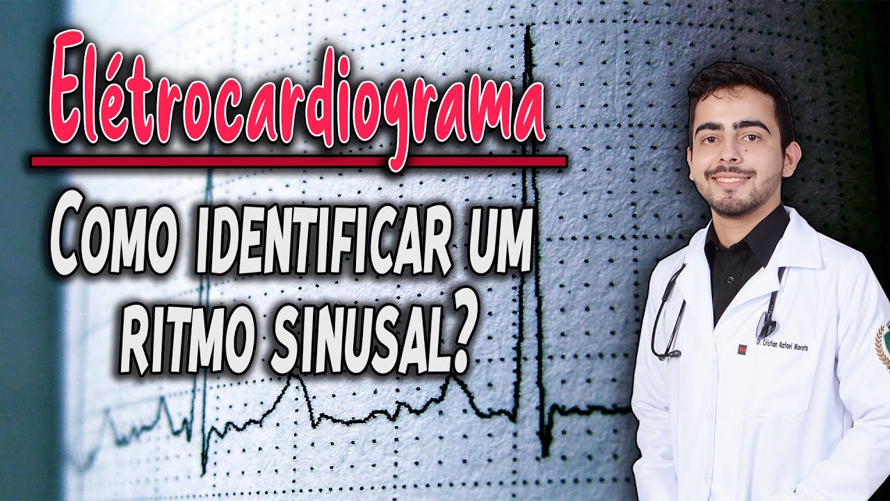 Fisiologia - Eletrocardiograma Normal │ (Capítulo 11) GUYTON