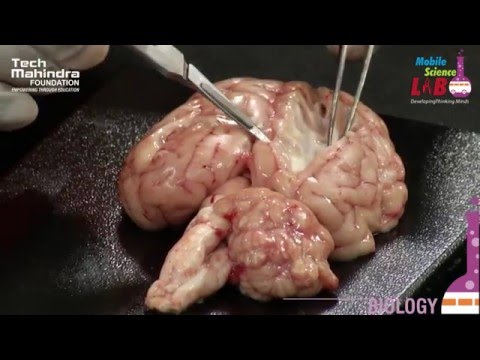 Dissection of a Brain Video