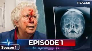 3 Cracked Vertebrae: Trainee Mechanic Survives High-Speed Ejection | Real ER Episode 1