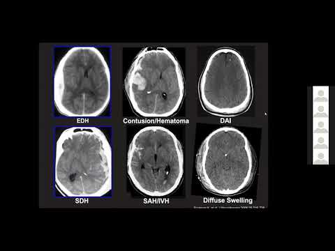 Medical Student Lecture Series: Neurotrauma with Zachary L. Hickman, MD